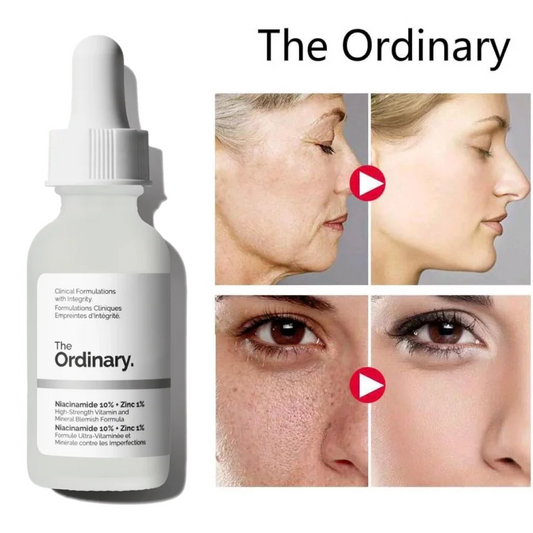 The Ordinary Niacinamide 10% + Zinc 1 % – 30ml