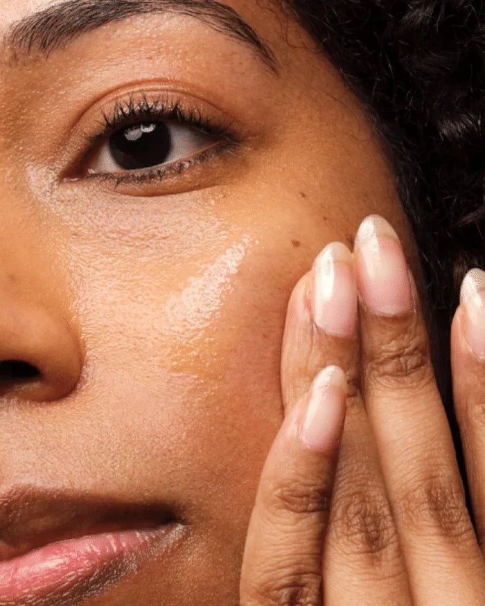 The Ordinary Niacinamide 10% + Zinc 1 % – 30ml